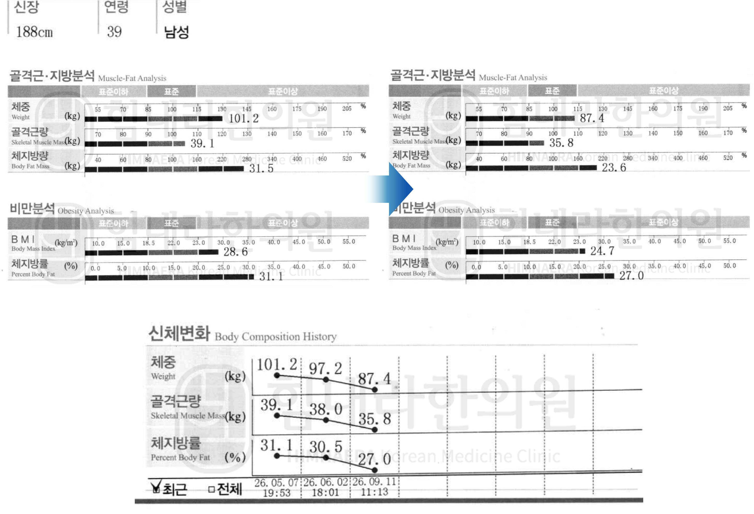 [30대 남성]체중관리 치료 경과 사례